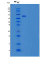 人CD14分子(CD14)重组蛋白Fc tag