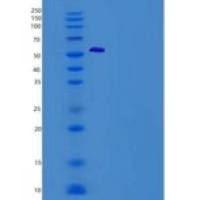 小鼠分泌粒蛋白Ⅲ(SCG3)重组蛋白His Tag