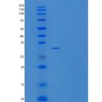 小鼠Carbonic Anhydrase XII / Car12重组蛋白His tag