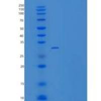 小鼠Carbonic Anhydrase XII / Car12重组蛋白His tag
