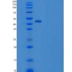 人羧肽酶B2(CPB2)重组蛋白His tag