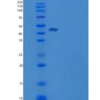 人羧肽酶B2(CPB2)重组蛋白His tag