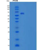 人CD14分子(CD14)重组蛋白Fc tag