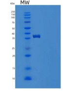 人S100钙结合蛋白A2(S100A2)重组蛋白Fc tag