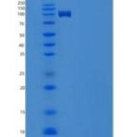小鼠叶绿素-1重组蛋白His tag