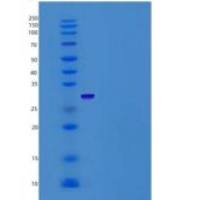 人RPE重组蛋白His Tag