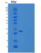 人CSRP1 / CSRP / CRP1重组蛋白His ta