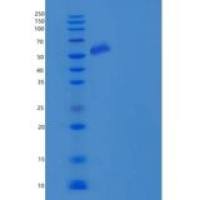 人PTGS2 / COX2 / PGHS-2重组蛋白His tag