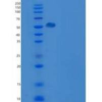 人凝血因子IX / FIX / F9重组蛋白His tag