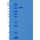 人Integrin beta 1重组蛋白His Tag