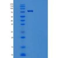 人Integrin beta 1重组蛋白His Tag