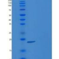 人ESM1 / Endocan重组蛋白His tag