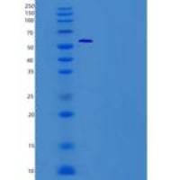 人ALDH7A1 / ATQ1重组蛋白His tag