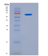 大鼠苹果酸脱氢酶1(MDH1)重组蛋白