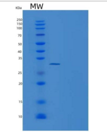 人β淀粉样蛋白40/βapp 40重组蛋白His & GST