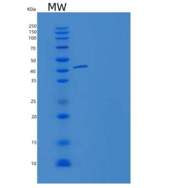 人非受体型蛋白酪氨酸磷酸酶12(PTPN12)重组蛋白