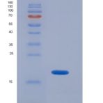 人超氧化物歧化酶1(SOD1)重组蛋白