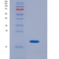人超氧化物歧化酶1(SOD1)重组蛋白