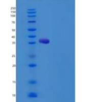 大鼠HepaCAM2重组蛋白His tag