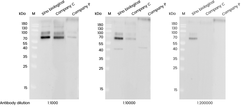 磷酸化抗体定制服务