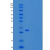 大鼠CLEC4D / CLECSF8重组蛋白His tag