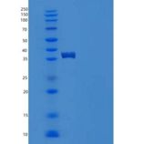 人S100钙结合蛋白A2(S100A2)重组蛋白Fc tag