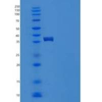 人S100钙结合蛋白A2(S100A2)重组蛋白Fc tag