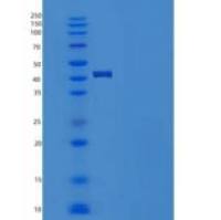 小鼠Serpinb3c重组蛋白His tag