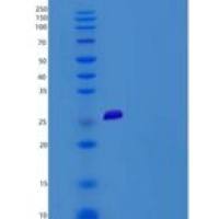 人CD200R1L / CD200R2 / CD200RLa重组蛋白His tag