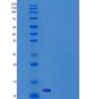 人S100A14 / S114重组蛋白His tag