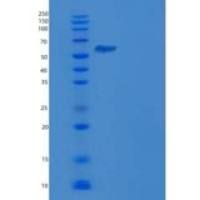 人NEK7重组蛋白His & GST tag