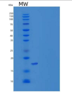 人REG1B / PSPS2重组蛋白His tag