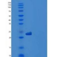 人含胶原三螺旋重复蛋白1(CTHRC1)重组蛋白His tag