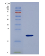 人髓鞘型脂肪酸结合蛋白(FABP8)重组蛋白
