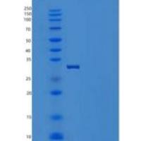 人SCARB3重组蛋白His tag