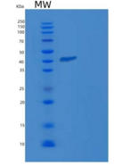 人PRL-2 / PTP4A2重组蛋白GST tag