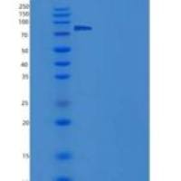 人β淀粉酶重组蛋白Fc Tag