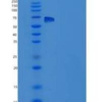 大鼠EphA7 / EHK3重组蛋白His tag