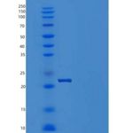 人胎盘催乳素/ CSH1重组蛋白His tag