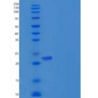 人CD32a / FCGR2A重组蛋白167 His, His tag