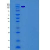 人P63 / TP63 / Tumor protein p63重组蛋白His & GST tag