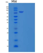 小鼠N-酰基鞘氨醇酰胺水解酶2(ASAH2)重组蛋白His