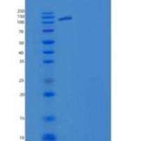 小鼠MFI2 / CD228 /黑转铁蛋白重组蛋白Fc tag