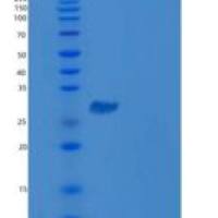 人β淀粉样蛋白38重组蛋白aa 672-709, His & GST tag
