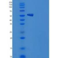 人CNDP2 / CPGL / PEPA重组蛋白His tag