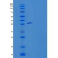 人含CUB域蛋白1(CDCP1)重组蛋白His Tag