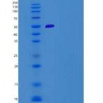 人TRP1 / TYRP1重组蛋白His tag