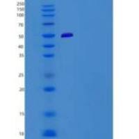 人TRP1 / TYRP1重组蛋白His tag