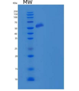 人PTGS2 / COX2 / PGHS-2重组蛋白His