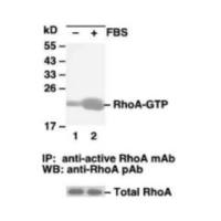 RhoA Activation Assay Kit